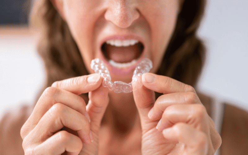 Is It Better To Get Braces Or Invisalign?