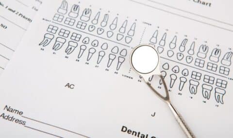 Misconceptions Surrounding Dental Implants