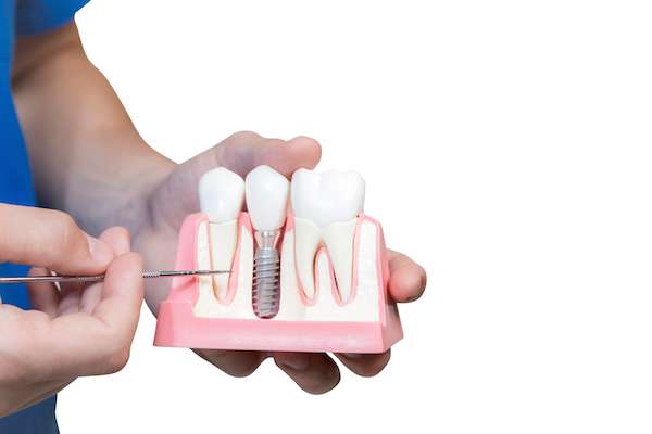 Can You Get Dental Implants if You Have Gum Disease from Lake Worth Dentistry in Greenacres, FL