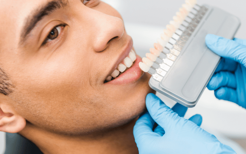 Do Dental Veneers Remove Enamel?