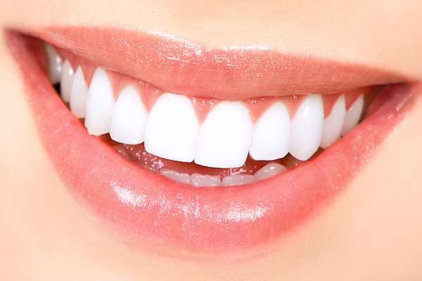 How Long Does Teeth Whitening Take from Lake Worth Dentistry in Greenacres, FL