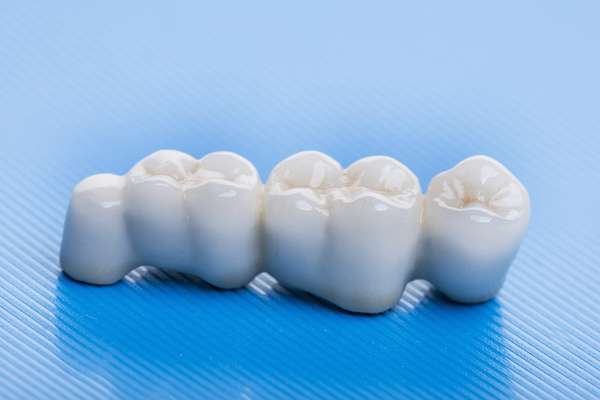 How Many Teeth Can Dental Bridges Replace from Lake Worth Dentistry in Greenacres, FL