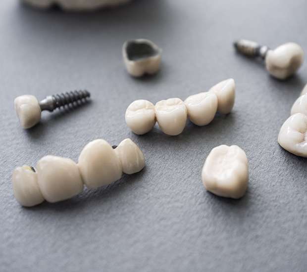 Greenacres The Difference Between Dental Implants and Mini Dental Implants