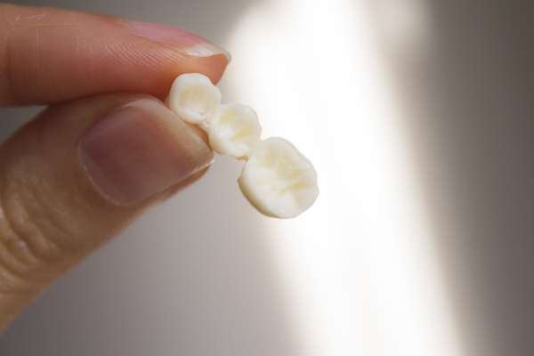 Replace Missing Teeth with Dental Bridges from Lake Worth Dentistry in Greenacres, FL